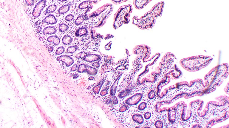 Dermatological